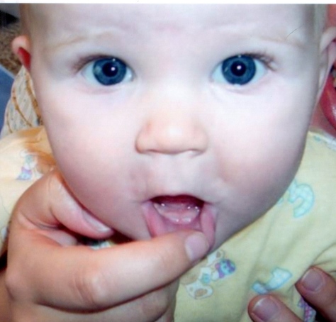 Charlie's first teeth - circa April 2004